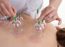 CUPPING